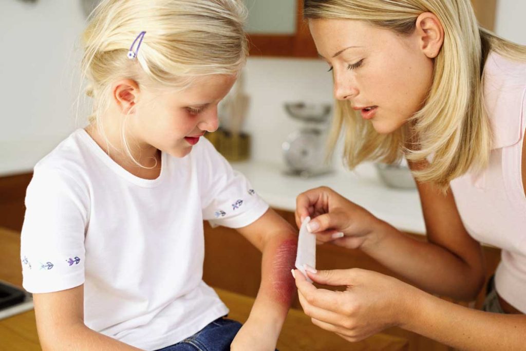 Aturan Pertolongan Pertama yang Wajib Diketahui Setiap Orang Tua